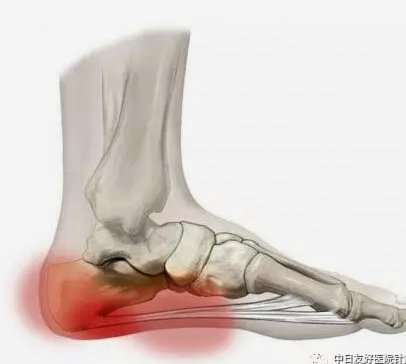 曼联体检蒂勒曼斯：伤情成疑